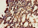 RBFA Antibody in Immunohistochemistry (Paraffin) (IHC (P))