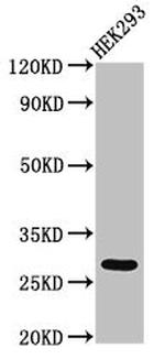 ANR49 Antibody in Western Blot (WB)