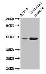 ARRDC3 Polyclonal Antibody