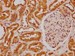 FIZ1 Antibody in Immunohistochemistry (Paraffin) (IHC (P))
