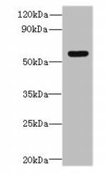 SLC35F5 Antibody in Western Blot (WB)