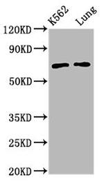 POF1B Antibody in Western Blot (WB)