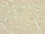 DHTKD1 Antibody in Immunohistochemistry (Paraffin) (IHC (P))
