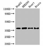 PNKD Polyclonal Antibody