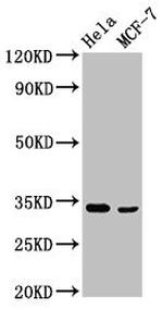 NFKBID Polyclonal Antibody