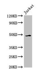 GABPB2 Antibody in Western Blot (WB)
