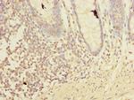 LMO3 Polyclonal Antibody