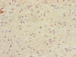 DYNC2LI1 Antibody in Immunohistochemistry (Paraffin) (IHC (P))