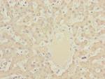 DYNC2LI1 Polyclonal Antibody