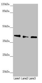 DYNC2LI1 Antibody in Western Blot (WB)