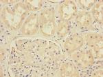 MTO1 Polyclonal Antibody