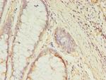 GCC1 Antibody in Immunohistochemistry (Paraffin) (IHC (P))