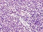 SMARCD1 Antibody in Immunohistochemistry (Paraffin) (IHC (P))