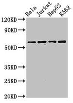 SMARCD1 Antibody in Western Blot (WB)