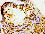 MASTL Antibody in Immunohistochemistry (Paraffin) (IHC (P))