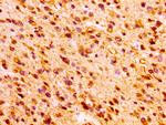 DNAJC30 Antibody in Immunohistochemistry (Paraffin) (IHC (P))