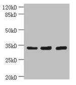 OTUD6B Antibody in Western Blot (WB)