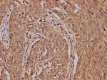 LRTM2 Antibody in Immunohistochemistry (Paraffin) (IHC (P))