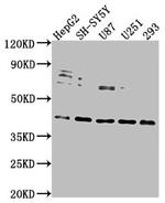 LRTM2 Antibody in Western Blot (WB)