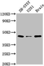 LRTM2 Antibody in Western Blot (WB)