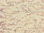 TXNDC5 Polyclonal Antibody