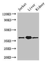 PINX1 Polyclonal Antibody