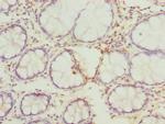 FAM82B Antibody in Immunohistochemistry (Paraffin) (IHC (P))