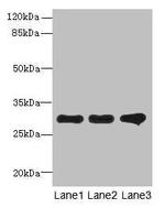 FAM82B Antibody in Western Blot (WB)
