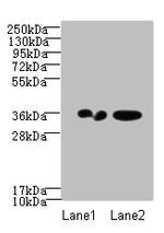 RPRD1A Antibody in Western Blot (WB)