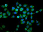WDFY2 Antibody in Immunocytochemistry (ICC/IF)
