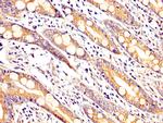 ARHGAP18 Antibody in Immunohistochemistry (Paraffin) (IHC (P))