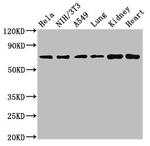 ARHGAP18 Antibody in Western Blot (WB)