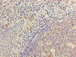 KIR3DL3 Polyclonal Antibody