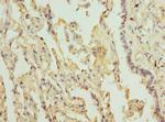 LILRB4 Polyclonal Antibody