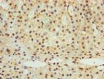 STK32A Antibody in Immunohistochemistry (Paraffin) (IHC (P))