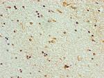 STK32A Antibody in Immunohistochemistry (Paraffin) (IHC (P))