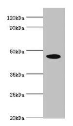 STK32A Antibody in Western Blot (WB)