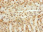 STK32A Polyclonal Antibody