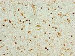 STK32A Antibody in Immunohistochemistry (Paraffin) (IHC (P))