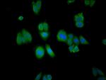 RABGGTA Polyclonal Antibody
