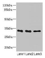 EXOSC8 Polyclonal Antibody