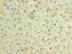 TCTN2 Polyclonal Antibody