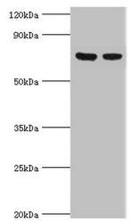 TCTN2 Antibody in Western Blot (WB)