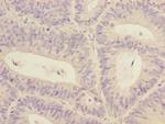 RBM17 Antibody in Immunohistochemistry (Paraffin) (IHC (P))