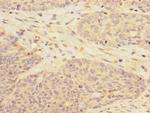 RBM17 Polyclonal Antibody
