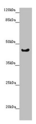 RBM17 Antibody in Western Blot (WB)
