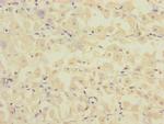 FCRL2 Polyclonal Antibody