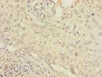 FCRL2 Antibody in Immunohistochemistry (Paraffin) (IHC (P))