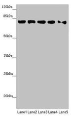 MCCC1 Antibody in Western Blot (WB)