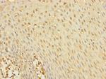 YME1L1 Polyclonal Antibody